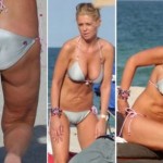 tara-reid-plastic-surgery-gone-bad